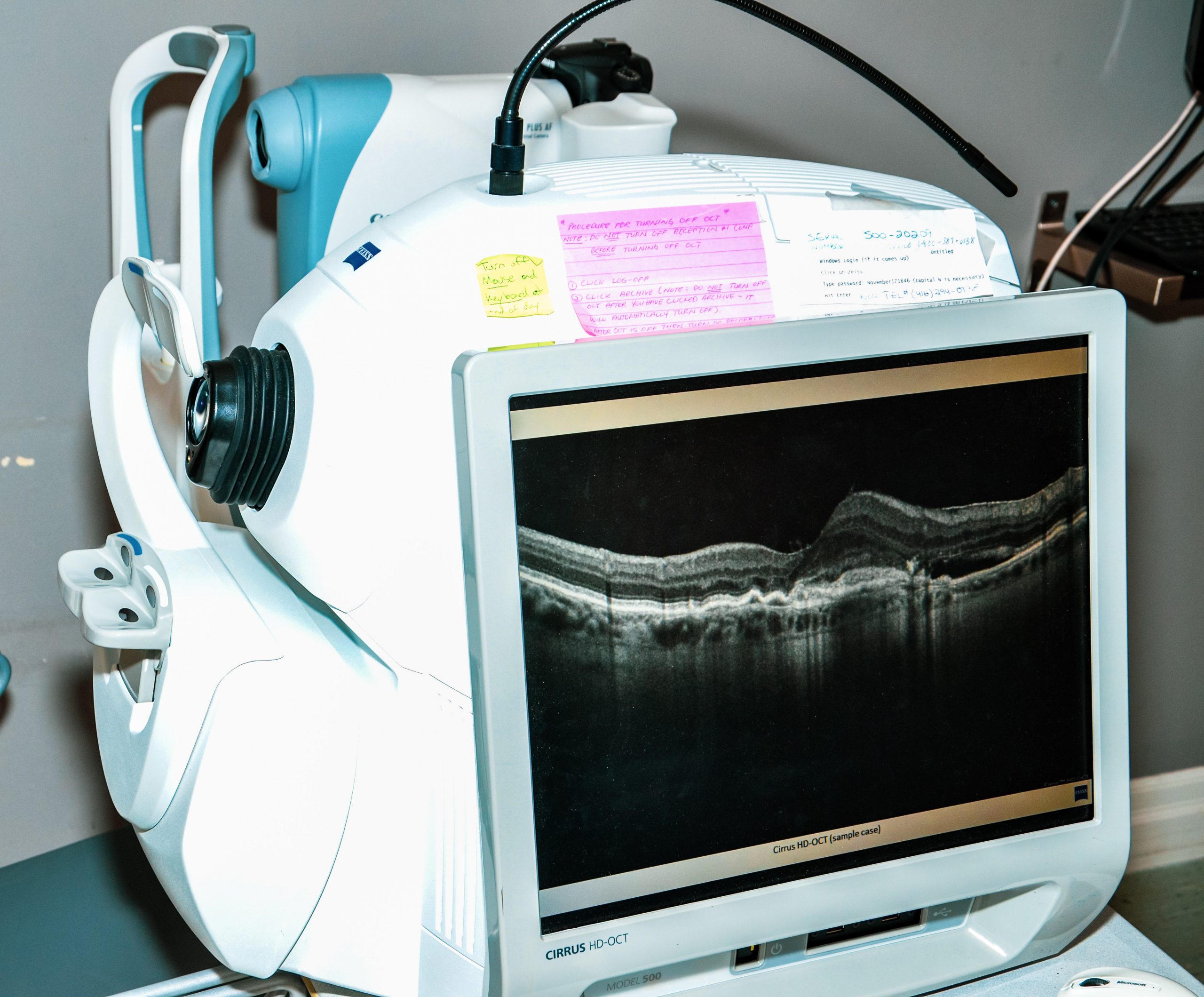 Optical Coherence Tomography (OCT) - Bay St. Eyecare